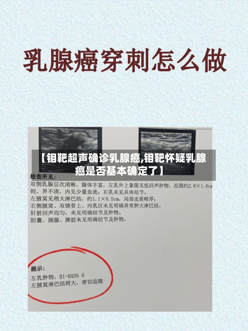 【钼靶超声确诊乳腺癌,钼靶怀疑乳腺癌是否基本确定了】-第1张图片