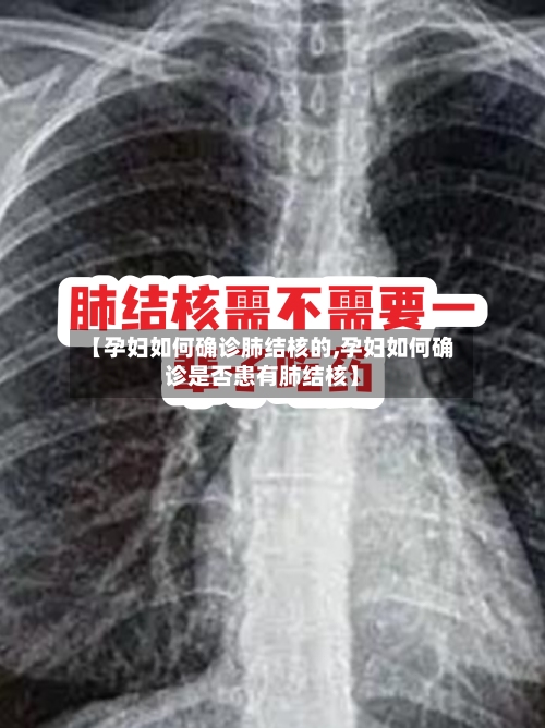 【孕妇如何确诊肺结核的,孕妇如何确诊是否患有肺结核】-第1张图片