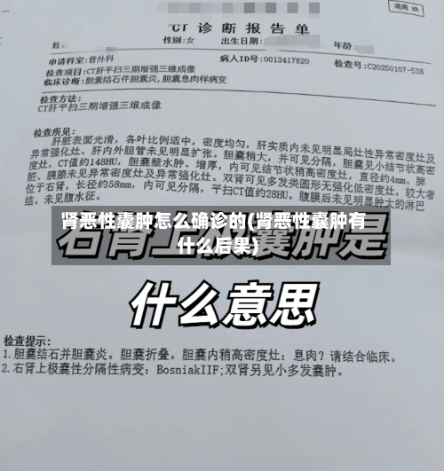 肾恶性囊肿怎么确诊的(肾恶性囊肿有什么后果)-第1张图片