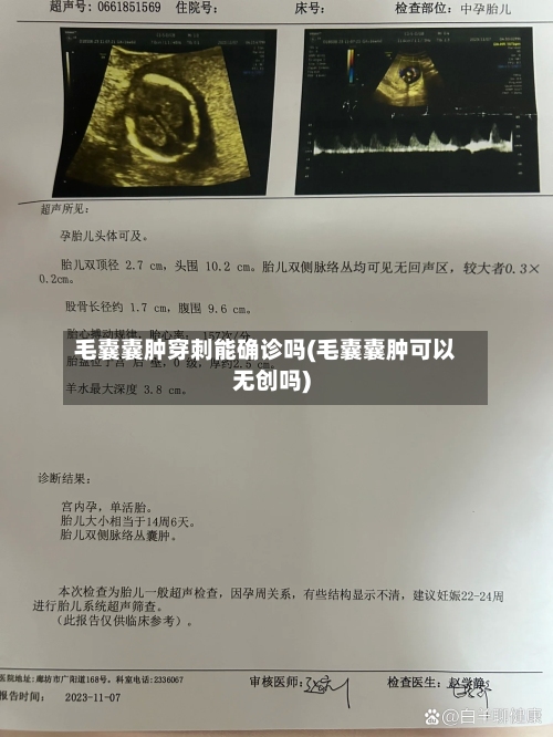 毛囊囊肿穿刺能确诊吗(毛囊囊肿可以无创吗)-第1张图片