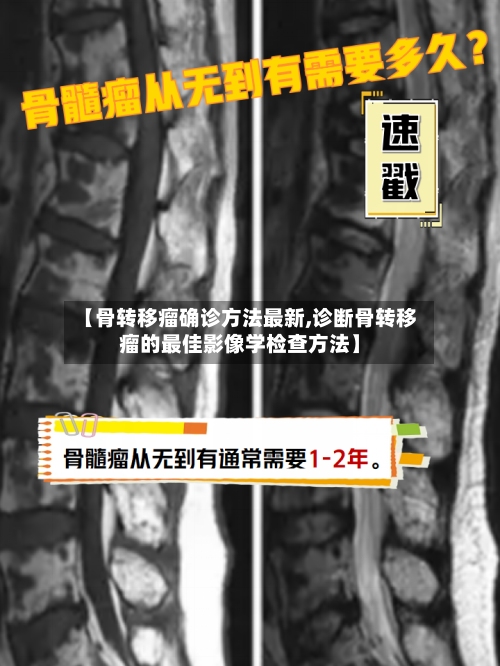 【骨转移瘤确诊方法最新,诊断骨转移瘤的最佳影像学检查方法】-第2张图片